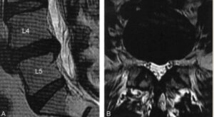 imagem de ressônancia magnética para explicar estudo cientifico publicado na pubmed