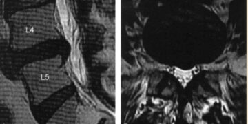 imagem de ressônancia magnética para explicar estudo cientifico publicado na pubmed